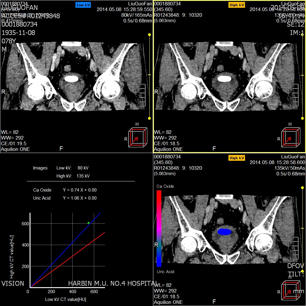 16789383717313.png 16789383717313.png