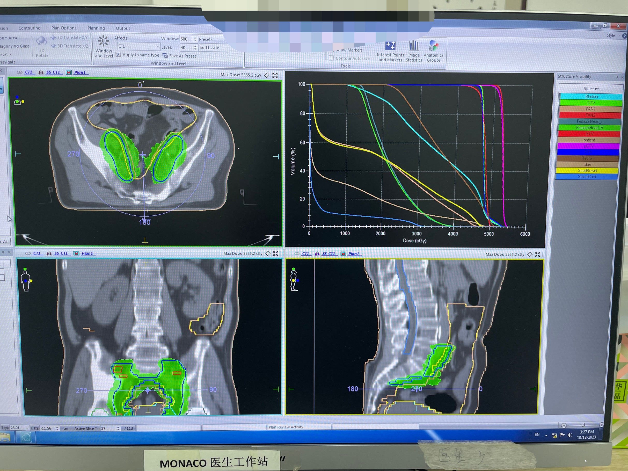 16982895159201.png 16982895159201.png