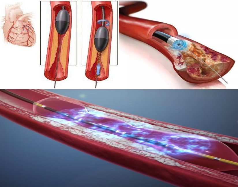 16998454492508.png 16998454492508.png