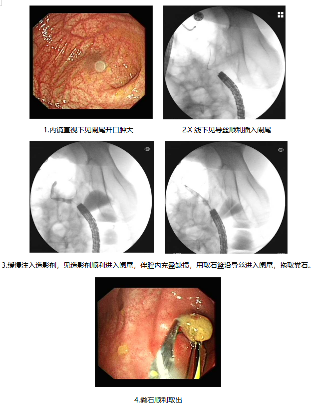 17026111135312.png 17026111135312.png