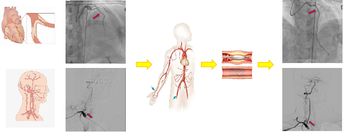 17161693719520.png 17161693719520.png