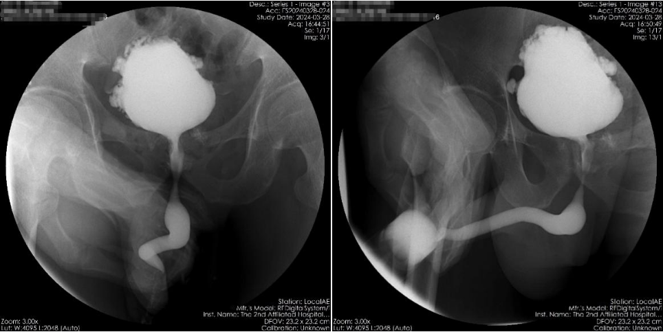 17161703567270.png 17161703567270.png