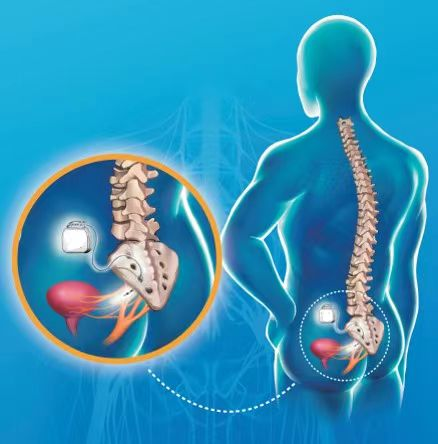 17161706093781.png 17161706093781.png