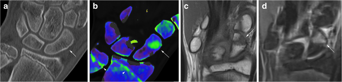 17182419923845.png 17182419923845.png