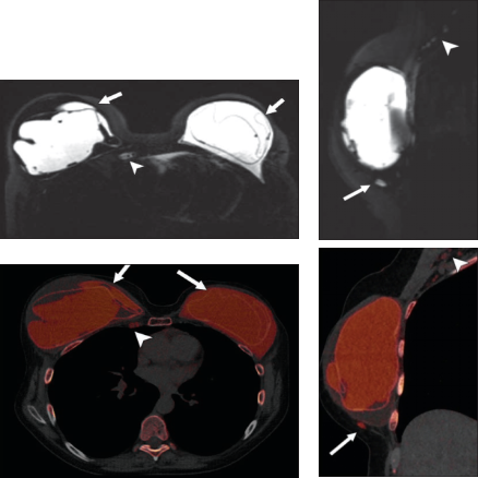 17182420506227.png 17182420506227.png