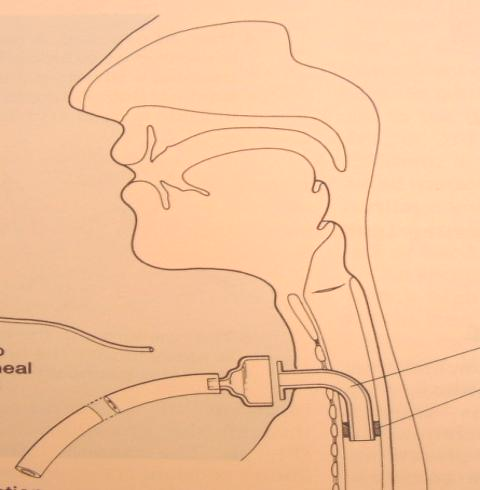 17204017938650.png 17204017938650.png