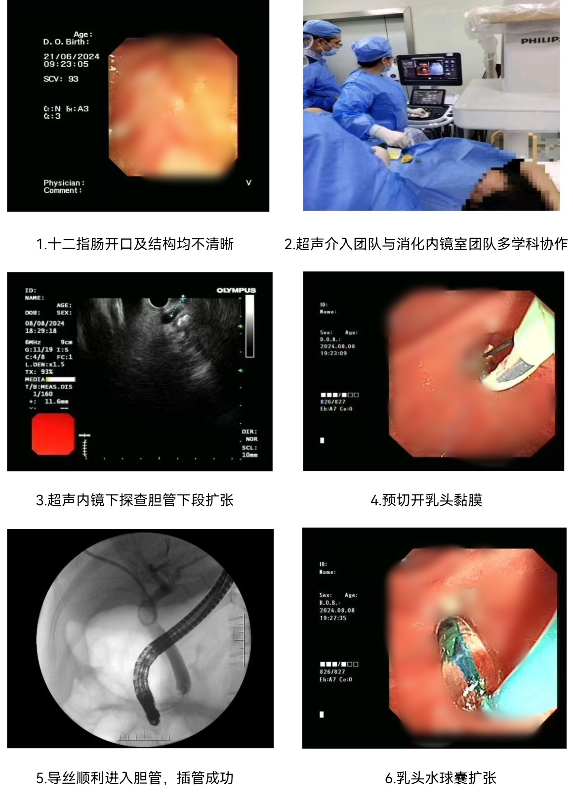 17240293884886.jpg 17240293884886.jpg