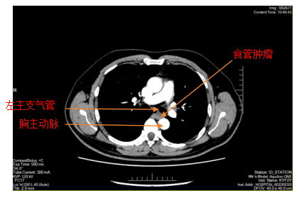 17267938109625.png 17267938109625.png