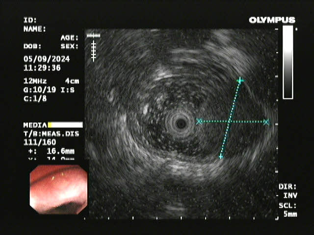 17267938288195.png 17267938288195.png