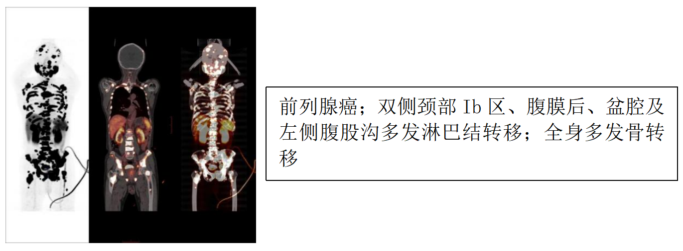 17407037837356.png 17407037837356.png