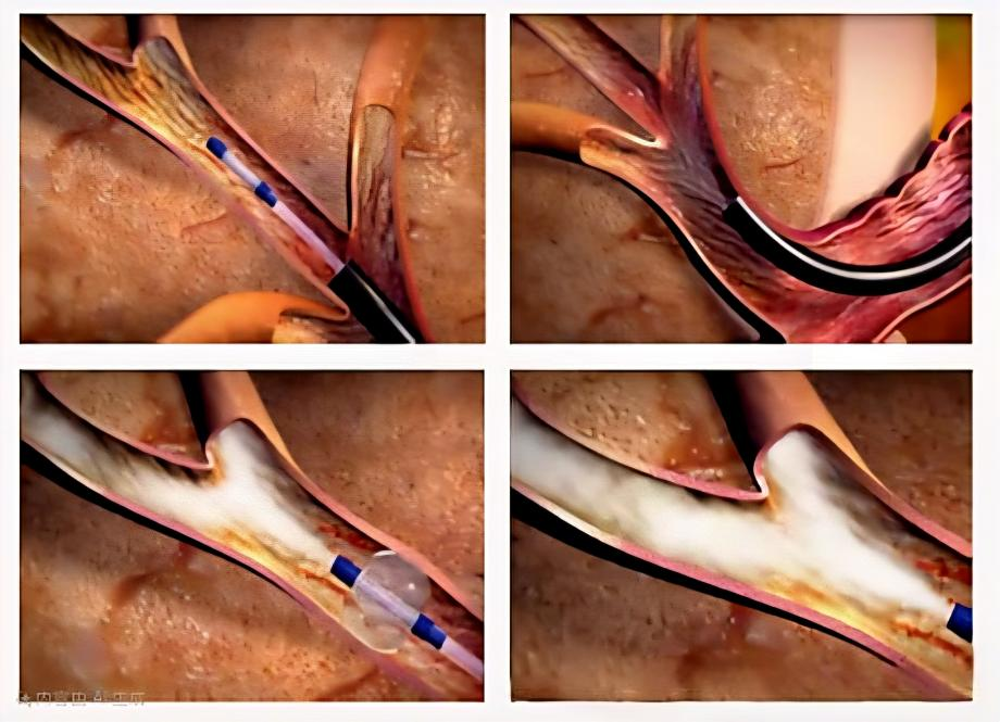 17506406995677.png 17506406995677.png