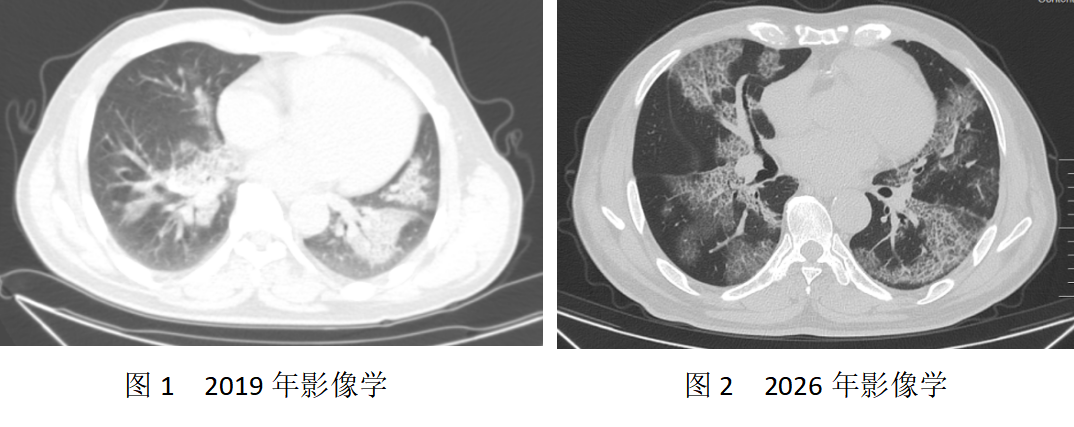 17748304367067.png 17748304367067.png